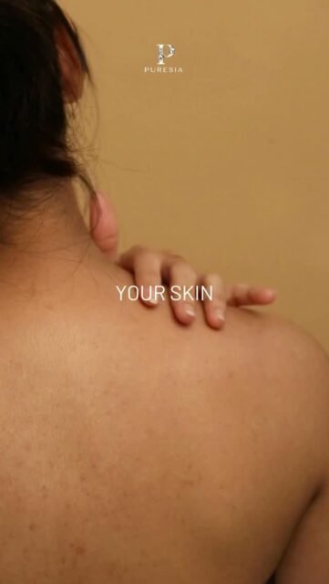 Every mark tells a story of growth, strength, and transformation. It’s time to embrace the skin you’re in while giving it the nourishment it deserves.Coming soon: A new ritual for your body and mind. Beyond the Marks. Healed by PURESIA.#ConfidenceInEveryMark #PuresiaSkin #SelfLoveJourney #SkinNourishment #ComingSoon